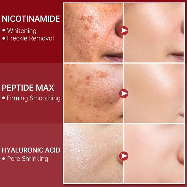 Niacinamide Dark Spot Remover Serum for Face Whitening Moisturizer Hyaluronic Acid Removal Freckle Facial Serum Skin Care