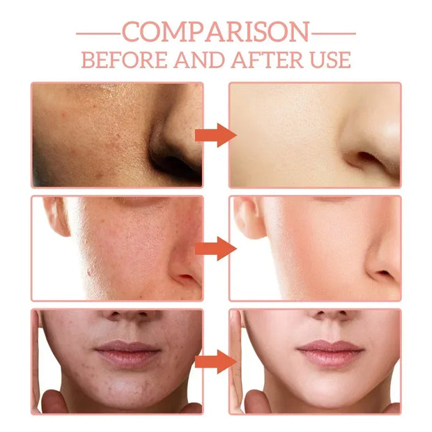 Face Serum for Moisturizing Whitening Vitamin C Anti Wrinkle Aging Hyaluronic Acid Shrink Pores Essence Skin Care Cosmetic 30ml