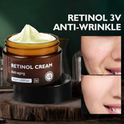 Retinol Face Cream Anti-Aging Remove Wrinkle Firming Lifting Whitening Brightening Moisturizing Hyalronic Acid Facial Skin Care
