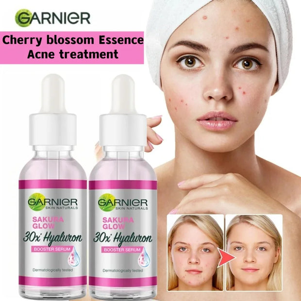 Garnier Cherry Blossom Shine Enhancing Acne Treatment Serum with Hyaluronic Acid - Suitable for Dry, Sensitive Skin